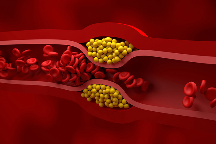 Cholesterol 101: What You Need to Know for a Healthy Heart
